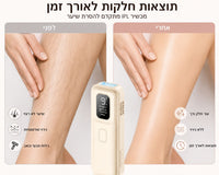 אפילטור לייזר קבוע